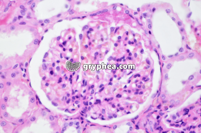 Glomérule Rein Singe x160 - gryphea.com